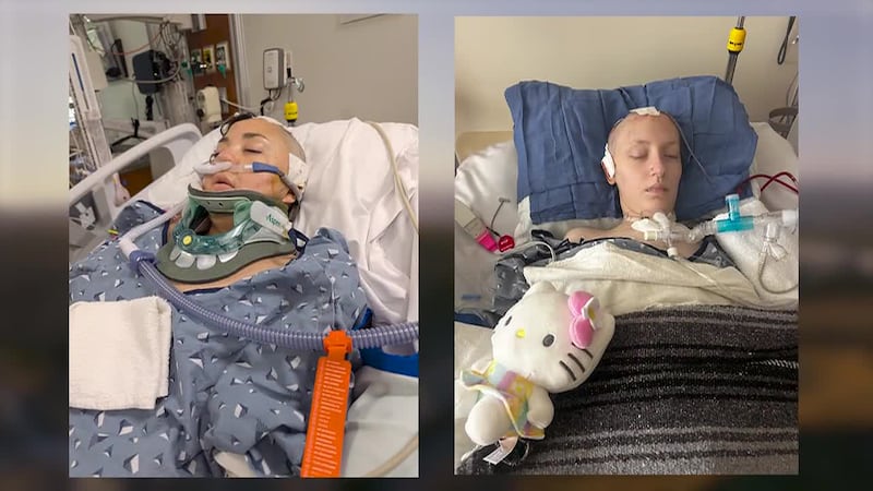 An investigation reports that two women suffered life-threatening brain injuries after riding...