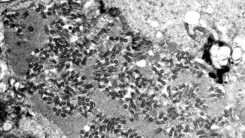 This undated electron microscope image made available by the Centers for Disease Control and...