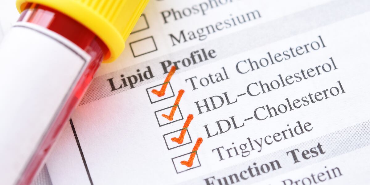 what not to drink before c lipid panel Cholesterol : LearnYourLipids On Your Side: Who should