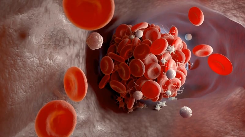 Blood Clot
